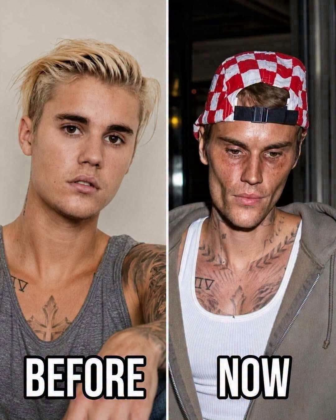 Justin Bieber’s Public Turning Point: From Teenage Stardom to Personal Growth
