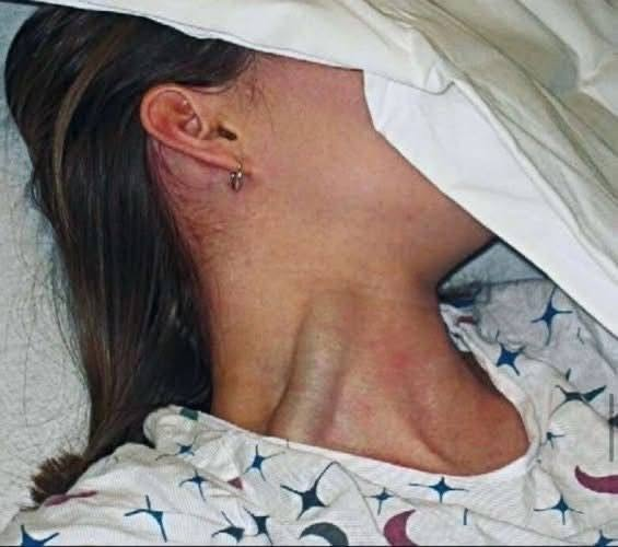 She Woke Up With Marks She Couldn’t Explain