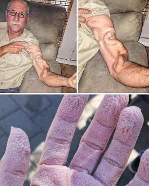 Man Stretches His Arm — Doctors Say This Is What Actually Happened