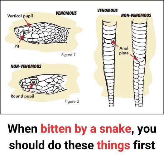 When bitten by a snake, you should do these things first