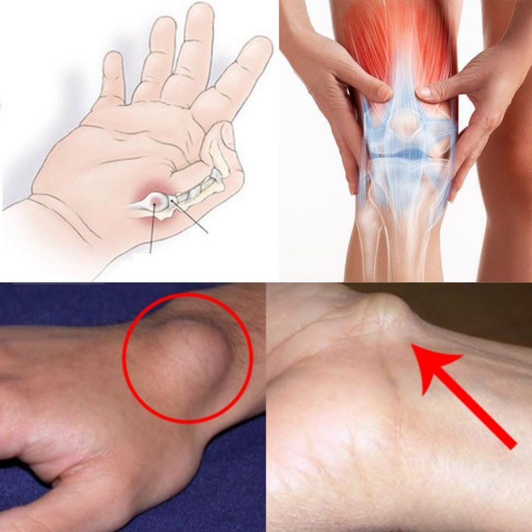 Healing Power And Important Safety Tips Of Castor Leaves