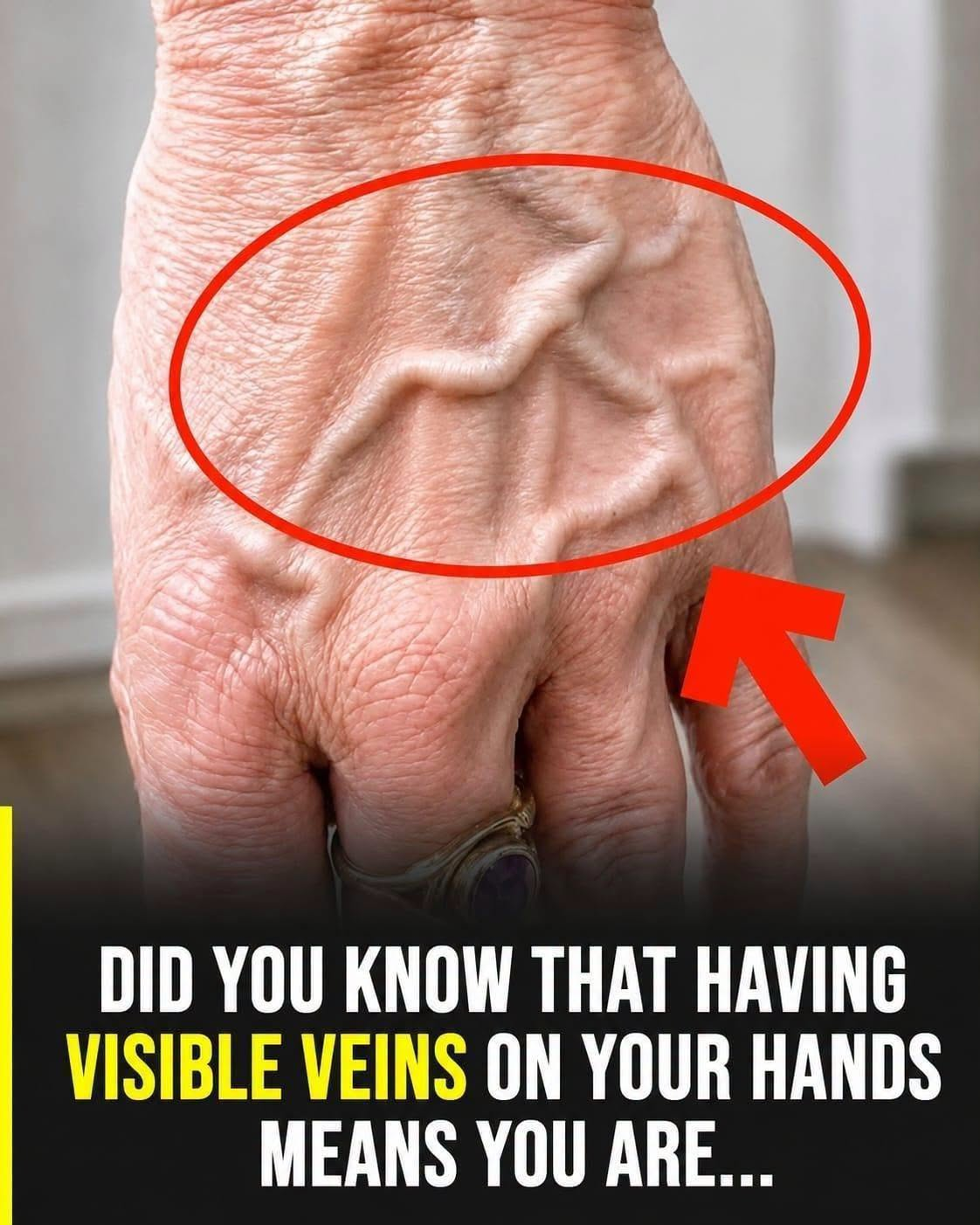 What Do Visible Veins Really Mean? Understanding the Causes and When to Pay Attention