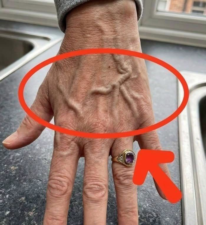 If your veins are visible in your hand, it is a signal