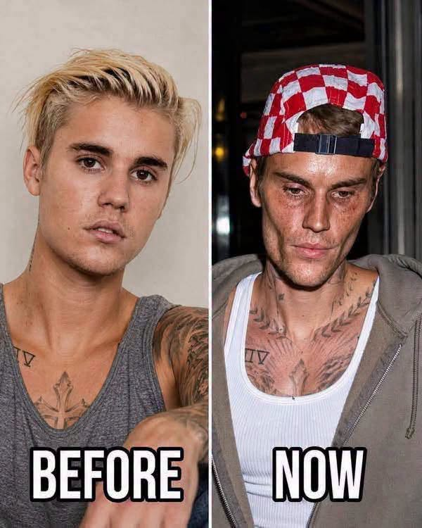 Justin Bieber admits that he tested positive for…See more