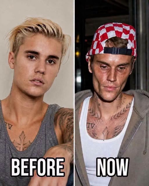 Justin Bieber admits that he tested positive for…