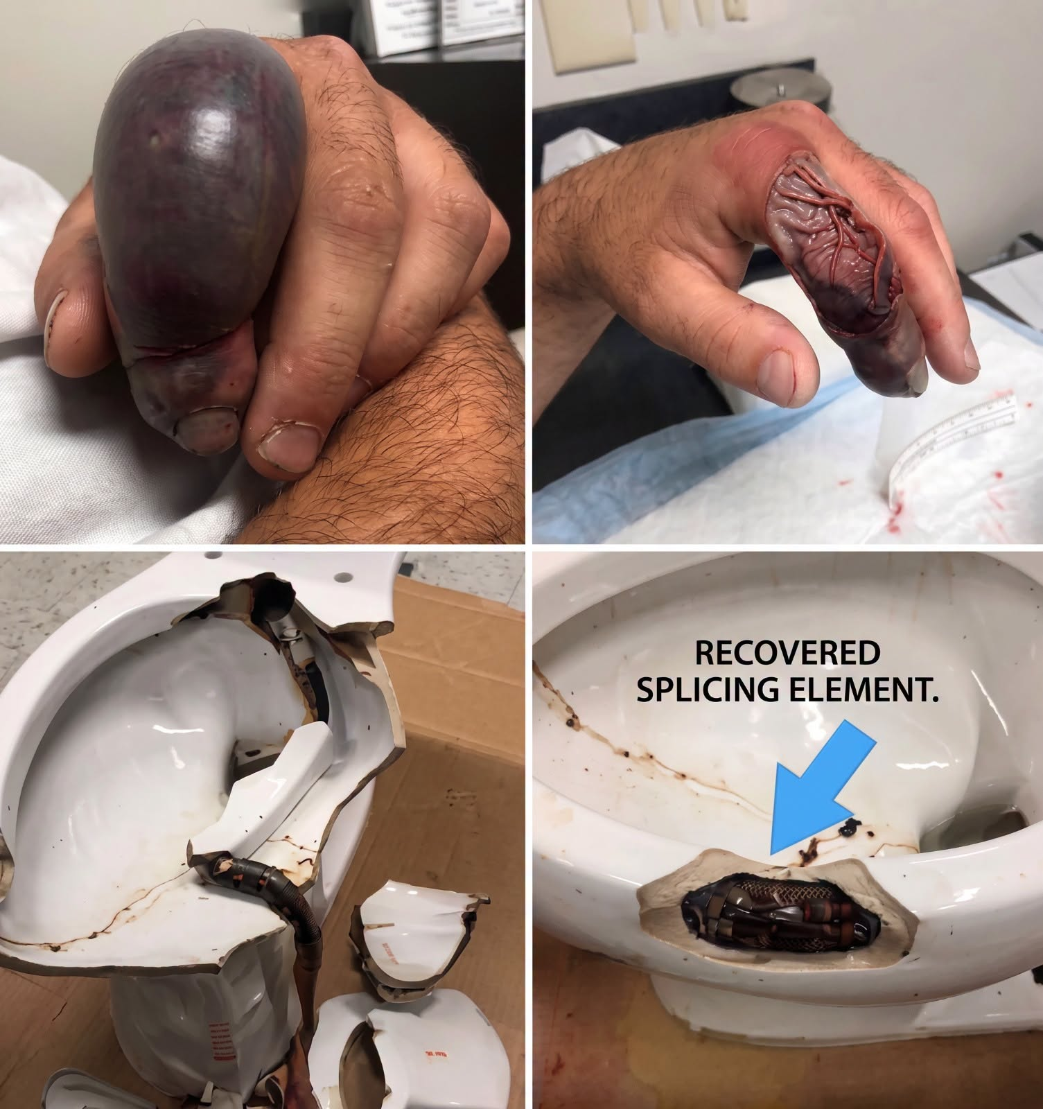 He went to the bathroom without knowing that there was a…See more